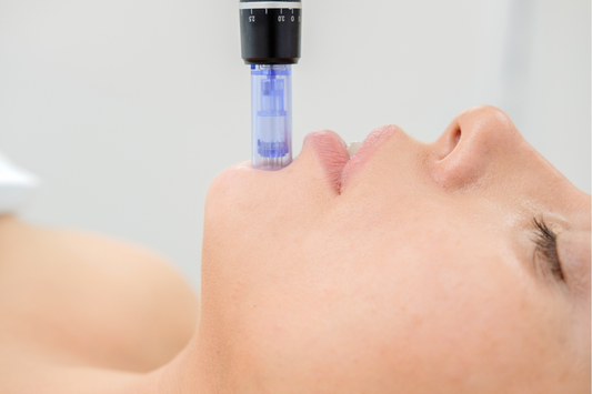 Micro needling